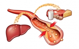 Повышение холестерина в крови и средства, его понижающие