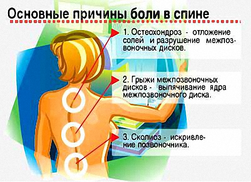 Ошибки приводящие к появлению болей в спине
